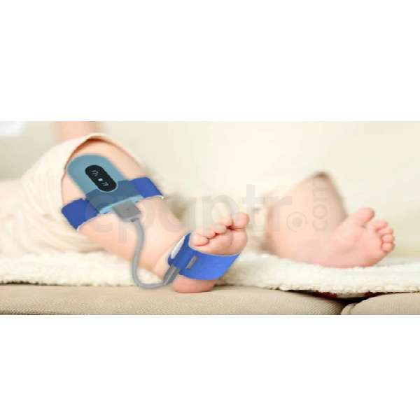 Viatom Wellue BabyO2 Yeni Doğan-Pramatüre Bebekler için Pulse Oksimetre Cihazı
