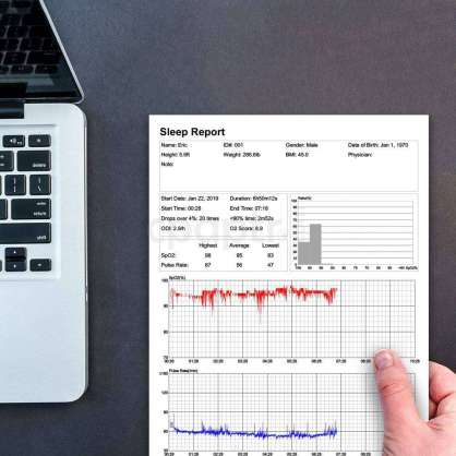 SleepU Pulse Oksimetre -Uyku Apnesi Hastaları için PC Raporu ile Bluetooth İzleyici